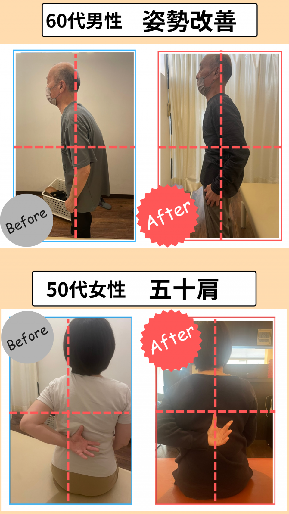 Before After 1