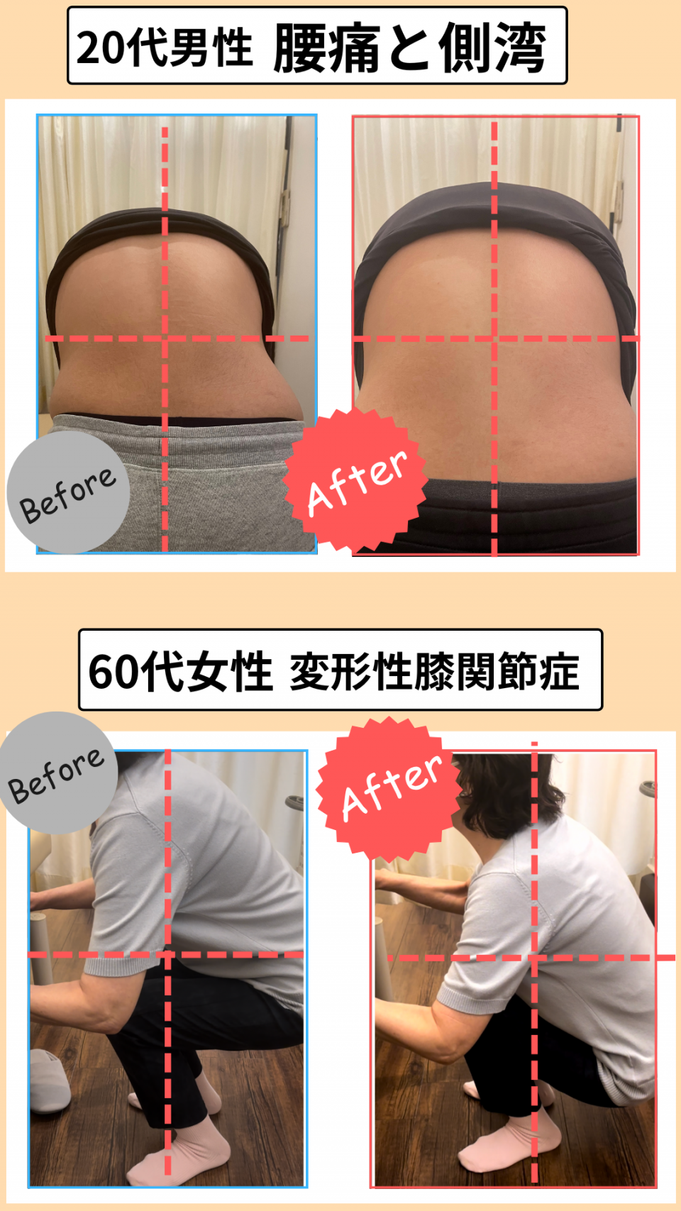 Before After 2